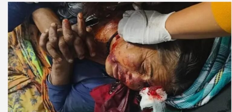 बड़ी खबर: लैंसडौन में महिला पर जंगल में अचानक भालू ने किया हमला, गंभीर हालत में एम्स ऋषिकेश रेफर