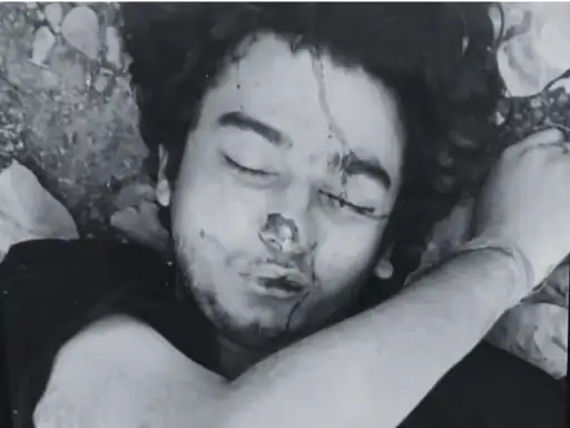 देहरादून के जंगल में मिला युवक का शव:पार्षद ने देखा, पास में पड़े थे इंजेक्शन; पहचान बाकी 12 image resize color correction and ai 1 1764842750